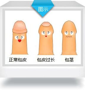 怎么判断包皮是否过长